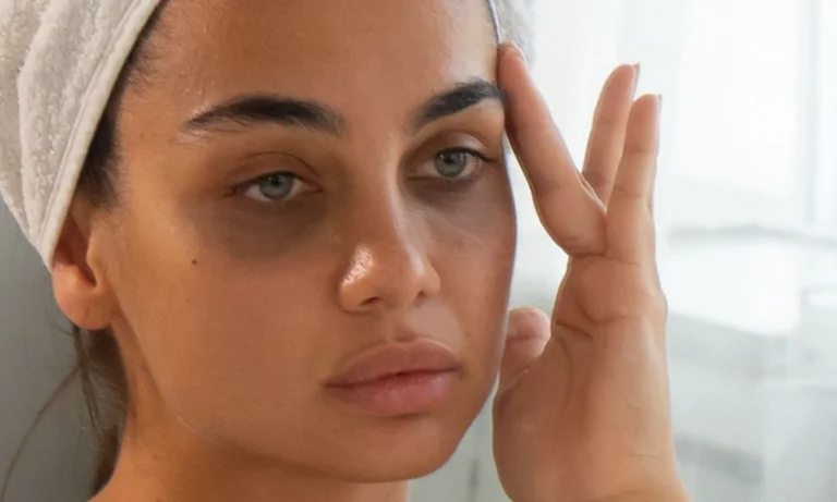 A young woman with visible dark circles under her eyes, gently touching her face while looking in the mirror.