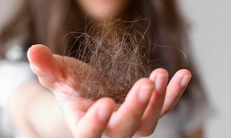A person holding a clump of fallen hair strands in their hand, showing symptoms of hair fall.