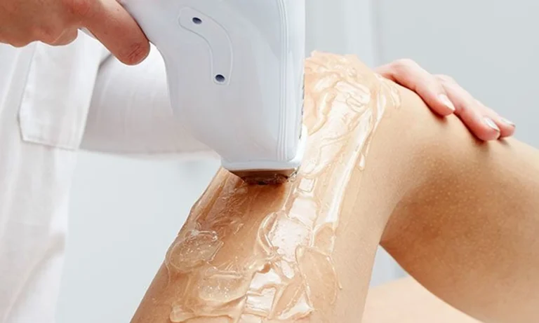 Close-up of a laser hair removal device being applied to a person’s leg with cooling gel during treatment.