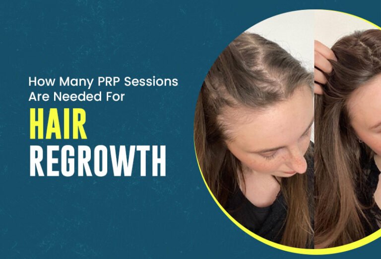 PRP-Dermatologist-In-Jaipur